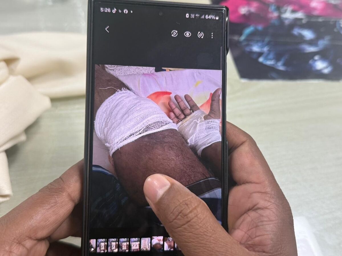 হামলায় আহত এক ব্যবসায়ী